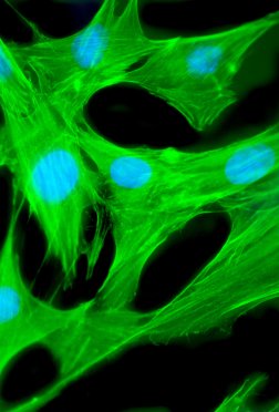 Fibroblast: Tubulin