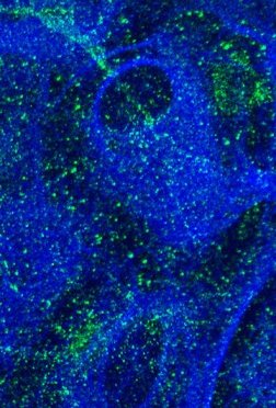Astroglia: NF-kappaB