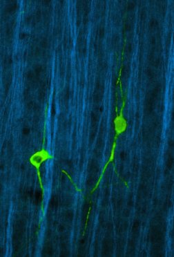 Neuron (Cortex): nNOS
